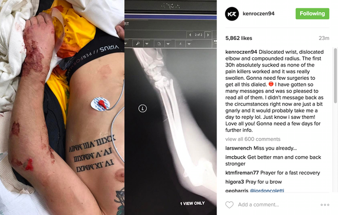 roczen-x-ray